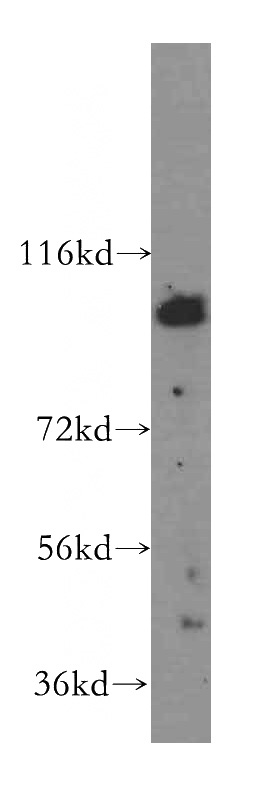 HEK-293 cells were subjected to SDS PAGE followed by western blot with Catalog No:112006(KIF20A antibody) at dilution of 1:500