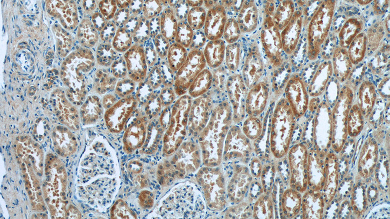 Immunohistochemistry of paraffin-embedded human kidney tissue slide using Catalog No:113007(N4BP3 Antibody) at dilution of 1:50 (under 10x lens)