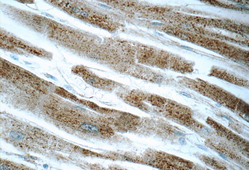 Immunohistochemistry of paraffin-embedded human heart tissue slide using Catalog No:112547(MCHR1 Antibody) at dilution of 1:50 (under 40x lens)