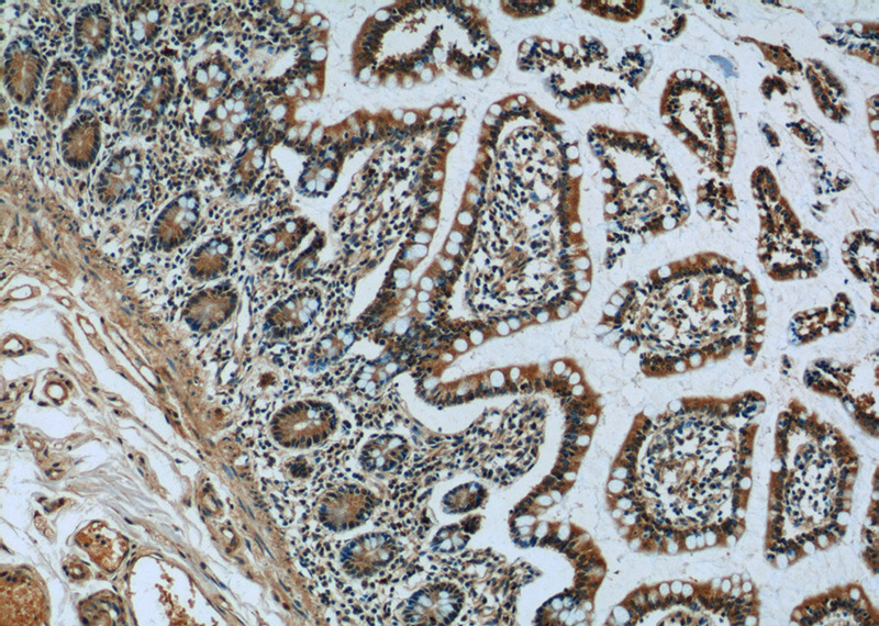 Immunohistochemistry of paraffin-embedded human small intestine tissue slide using Catalog No:115462(SNRPD3 Antibody) at dilution of 1:50 (under 10x lens)