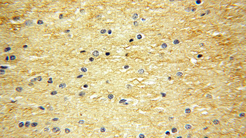 Immunohistochemical of paraffin-embedded human brain using Catalog No:113133(NTF3 antibody) at dilution of 1:100 (under 40x lens)