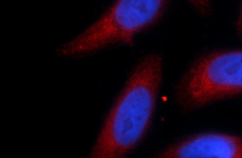 Immunofluorescent analysis of HeLa cells using Catalog No:116322(TRIM63 Antibody) at dilution of 1:25 and Rhodamine-Goat anti-Rabbit IgG