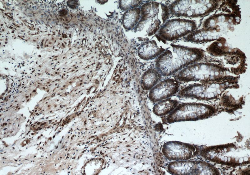 Immunohistochemical of paraffin-embedded human colon using Catalog No:115521(SP1 antibody) at dilution of 1:50 (under 10x lens)