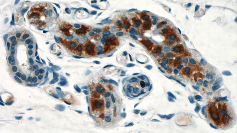 Immunohistochemical of paraffin-embedded human skin using Catalog No:116119(TIAF1 antibody) at dilution of 1:100 (under 40x lens)