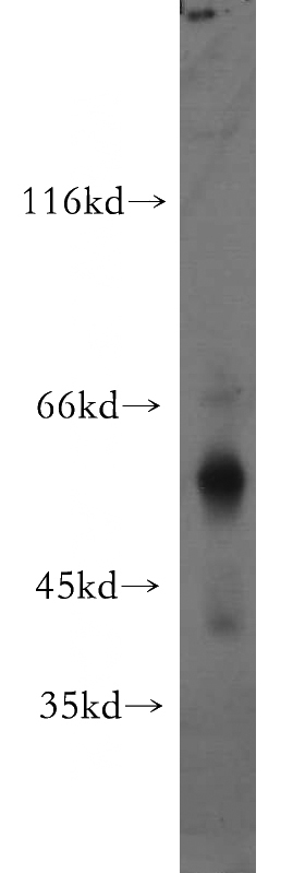 human testis tissue were subjected to SDS PAGE followed by western blot with Catalog No:116626(UPF3A antibody) at dilution of 1:500