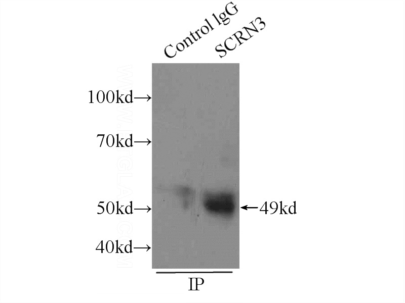 IP Result of anti-SCRN3 (IP:Catalog No:115021, 4ug; Detection:Catalog No:115021 1:800) with HEK-293 cells lysate 1760ug.