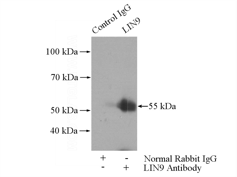 IP Result of anti-LIN9 (IP:Catalog No:112239, 4ug; Detection:Catalog No:112239 1:1000) with HEK-293 cells lysate 1100ug.