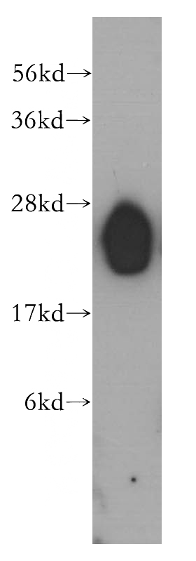 human heart tissue were subjected to SDS PAGE followed by western blot with Catalog No:112237(LIN7B antibody) at dilution of 1:500