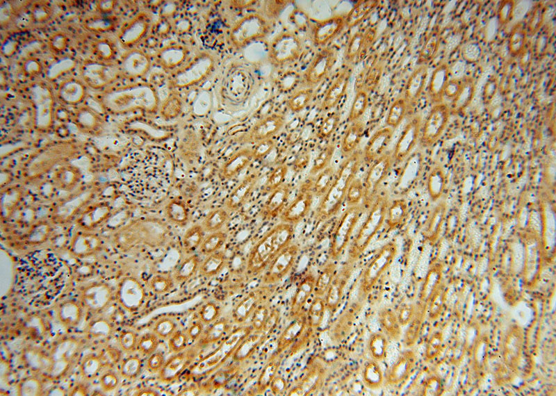 Immunohistochemical of paraffin-embedded human kidney using Catalog No:114359(PYGL antibody) at dilution of 1:100 (under 10x lens)