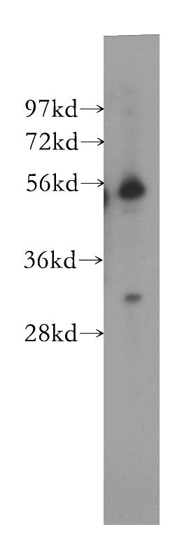 human placenta tissue were subjected to SDS PAGE followed by western blot with Catalog No:110778(FRS3 antibody) at dilution of 1:500