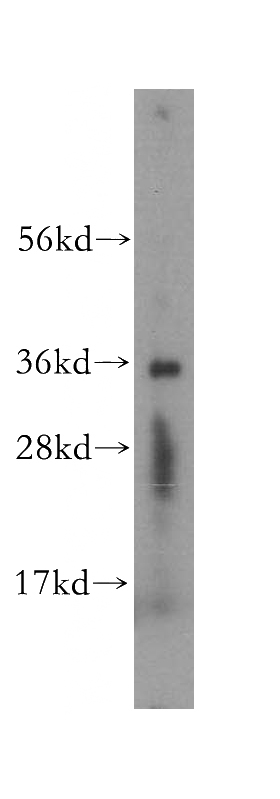 human adrenal gland tissue were subjected to SDS PAGE followed by western blot with Catalog No:115071(SDR39U1 antibody) at dilution of 1:500