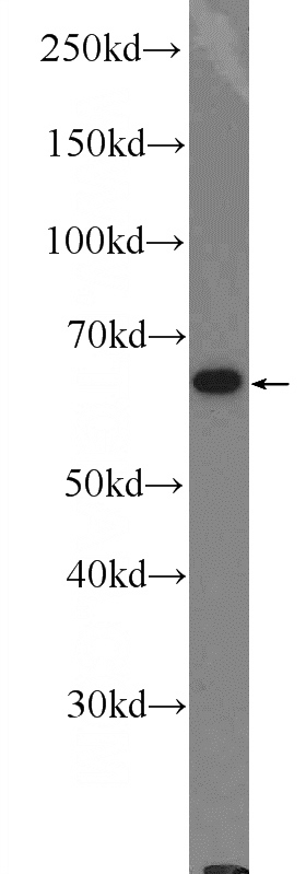 PC-3 cells were subjected to SDS PAGE followed by western blot with Catalog No:111838(IRF6 Antibody) at dilution of 1:600