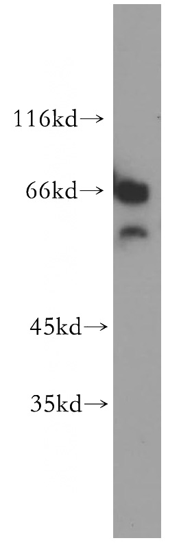 mouse testis tissue were subjected to SDS PAGE followed by western blot with Catalog No:109178(CDYL antibody) at dilution of 1:500