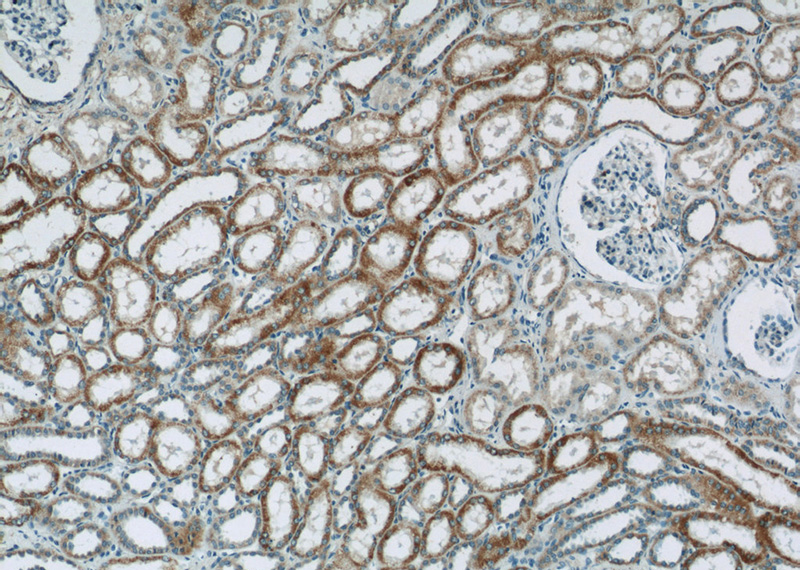 Immunohistochemistry of paraffin-embedded human kidney tissue slide using Catalog No:113088(NDUFV3 Antibody) at dilution of 1:50 (under 10x lens)