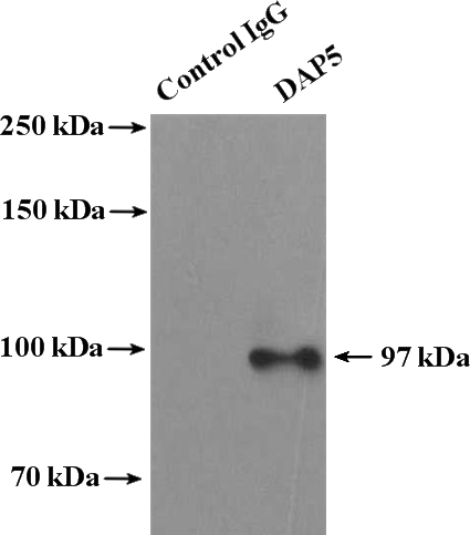 IP Result of anti-EIF4G2 (IP:Catalog No:109861, 4ug; Detection:Catalog No:109861 1:400) with MCF-7 cells lysate 3200ug.