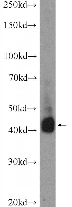 HL-60 cells were subjected to SDS PAGE followed by western blot with Catalog No:109033(CD38 Antibody) at dilution of 1:1000