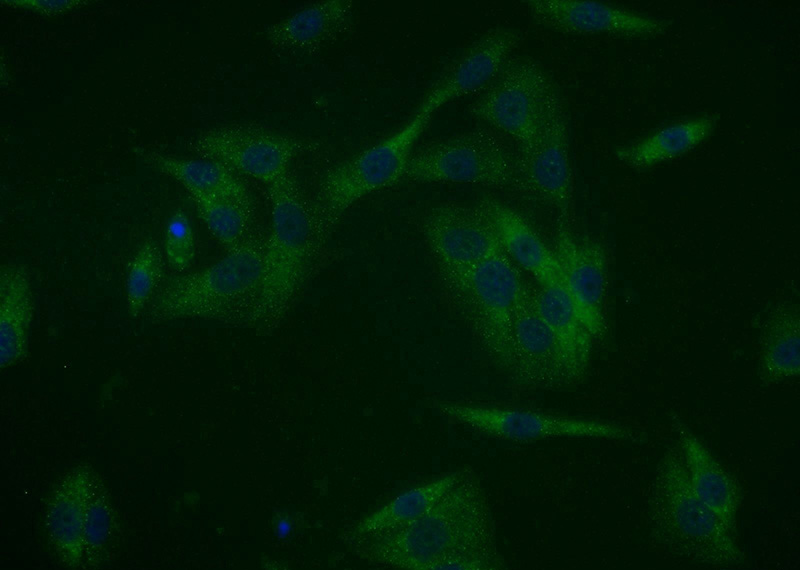 Immunofluorescent analysis of A375 cells using Catalog No:112379(MAGEA11 Antibody) at dilution of 1:25 and Alexa Fluor 488-congugated AffiniPure Goat Anti-Rabbit IgG(H+L)