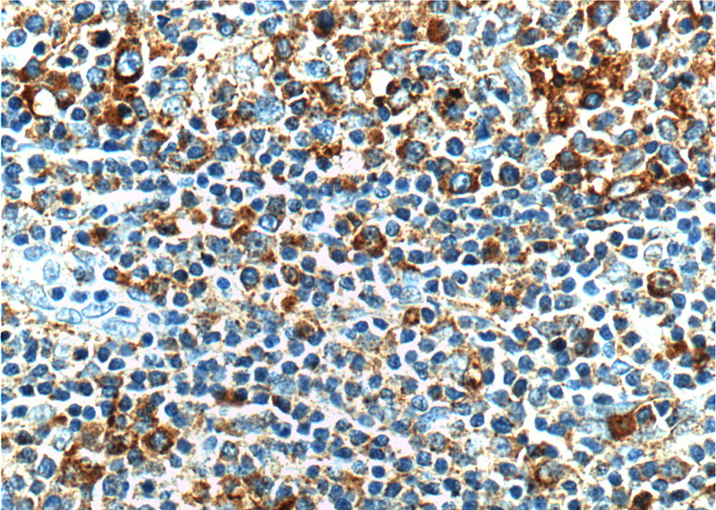 Immunohistochemistry of paraffin-embedded human tonsillitis tissue slide using Catalog No:108415(BAK Antibody) at dilution of 1:200 (under 40x lens).