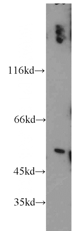 SH-SY5Y cells were subjected to SDS PAGE followed by western blot with Catalog No:114100(PPP2R2B antibody) at dilution of 1:500