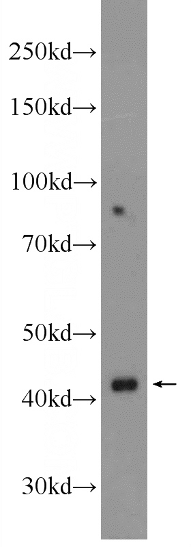 mouse liver tissue were subjected to SDS PAGE followed by western blot with Catalog No:116624(UPB1 Antibody) at dilution of 1:1000