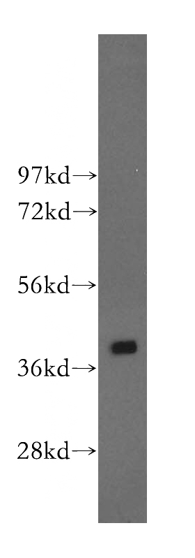 K-562 cells were subjected to SDS PAGE followed by western blot with Catalog No:108753(CAB39L antibody) at dilution of 1:400