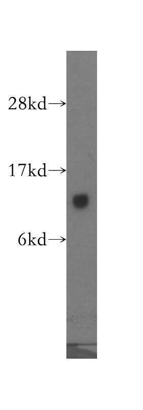mouse testis tissue were subjected to SDS PAGE followed by western blot with Catalog No:111228(GTF2A2 antibody) at dilution of 1:300