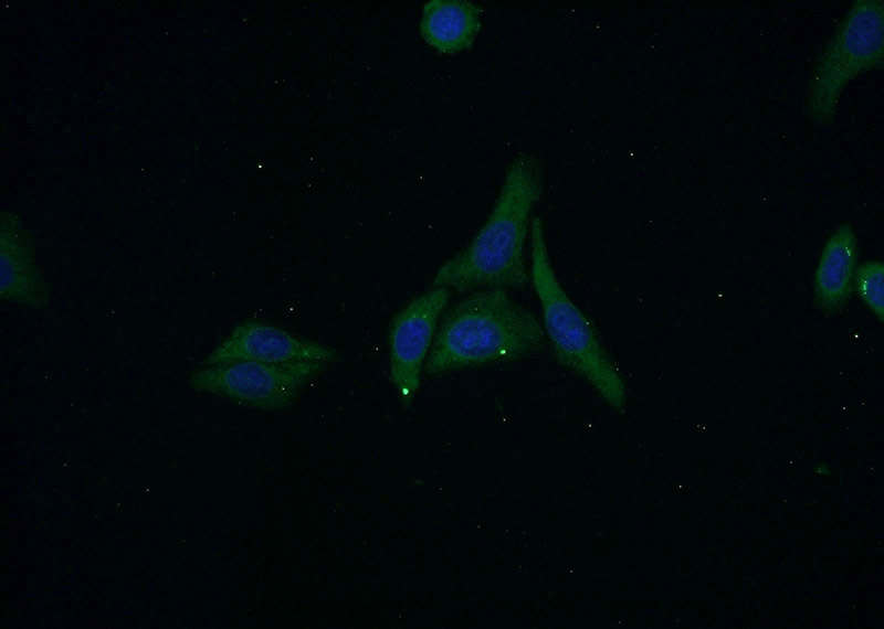 Immunofluorescent analysis of HepG2 cells using Catalog No:117179(ZNF460 Antibody) at dilution of 1:50 and Alexa Fluor 488-congugated AffiniPure Goat Anti-Rabbit IgG(H+L)