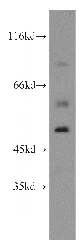 mouse brain tissue were subjected to SDS PAGE followed by western blot with Catalog No:115162(SGCE antibody) at dilution of 1:500