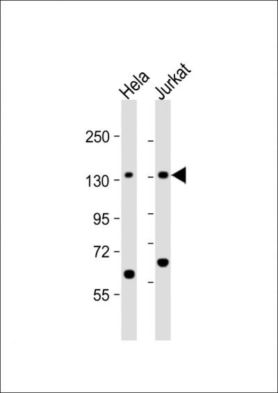 All lanes: Anti-SF3B3 Antibody (C-term) at 1:1000 dilutionnLane 1: Hela whole cell lysatenLane 2: Jurkat whole cell lysatennnLysates/proteins at 20 u03bcg per lane. nnSecondarynGoat Anti-Rabbit IgG,  (H+L), Peroxidase conjugated at 1/10000 dilution. nnPredicted band size: 136 kDannBlocking/Dilution buffer: 5% NFDM/TBST.
