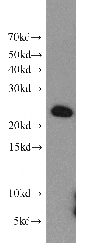 mouse kidney tissue were subjected to SDS PAGE followed by western blot with Catalog No:109444(COMMD5 antibody) at dilution of 1:1000