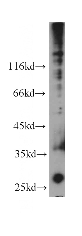 HeLa cells were subjected to SDS PAGE followed by western blot with Catalog No:107647(TSPAN3 antibody) at dilution of 1:1000