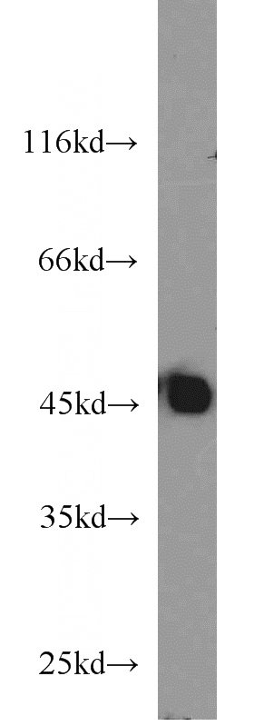 mouse heart tissue were subjected to SDS PAGE followed by western blot with Catalog No:113627(PDK4 antibody) at dilution of 1:1000