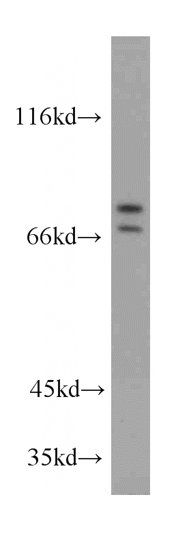 mouse kidney tissue were subjected to SDS PAGE followed by western blot with Catalog No:107696(ACSL3 antibody) at dilution of 1:300