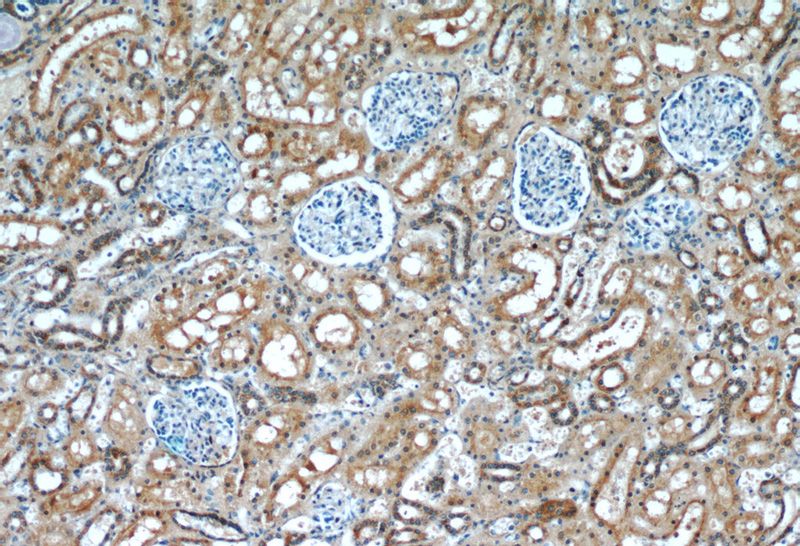 Immunohistochemistry of paraffin-embedded human kidney slide using Catalog No:107549(ZYX Antibody) at dilution of 1:50