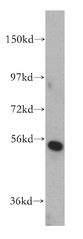 Jurkat cells were subjected to SDS PAGE followed by western blot with Catalog No:109476(CORO2B antibody) at dilution of 1:300