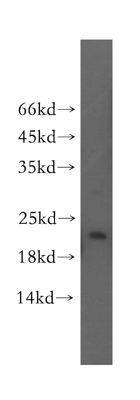 human brain tissue were subjected to SDS PAGE followed by western blot with Catalog No:116889(YPEL1 antibody) at dilution of 1:400