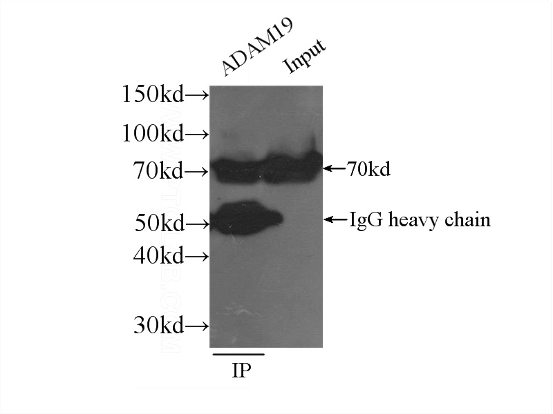 IP Result of anti-ADAM19 (IP:Catalog No:107764, 4ug; Detection:Catalog No:107764 1:300) with NIH/3T3 cells lysate 1200ug.