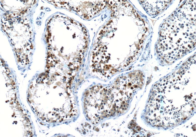 Immunohistochemistry of paraffin-embedded human testis tissue slide using Catalog No:109666(CCNE2 Antibody) at dilution of 1:50 (under 10x lens).