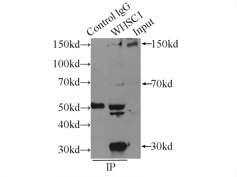 IP Result of anti-WHSC1 (IP:Catalog No:116826, 3ug; Detection:Catalog No:116826 1:300) with HeLa cells lysate 2000ug.