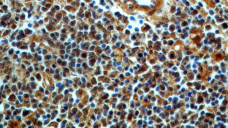 Immunohistochemical of paraffin-embedded human spleen using Catalog No:108935(CAPG-Specific antibody) at dilution of 1:50 (under 40x lens)
