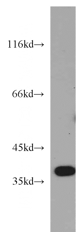 mouse brain tissue were subjected to SDS PAGE followed by western blot with Catalog No:117089(B3GALT6 antibody) at dilution of 1:500