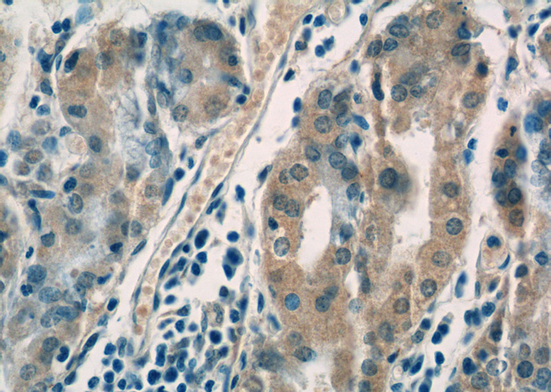Immunohistochemistry of paraffin-embedded human stomach tissue slide using Catalog No:111683(IGFBP1 Antibody) at dilution of 1:50 (under 40x lens)