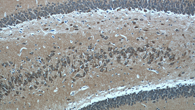 Immunohistochemical of paraffin-embedded rat brain using Catalog No:109209(CHAT antibody) at dilution of 1:50 (under 10x lens)