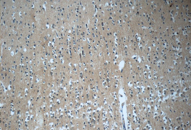Immunohistochemistry of paraffin-embedded human brain tissue slide using Catalog No:109951(DNAJC6 Antibody) at dilution of 1:50 (under 10x lens)