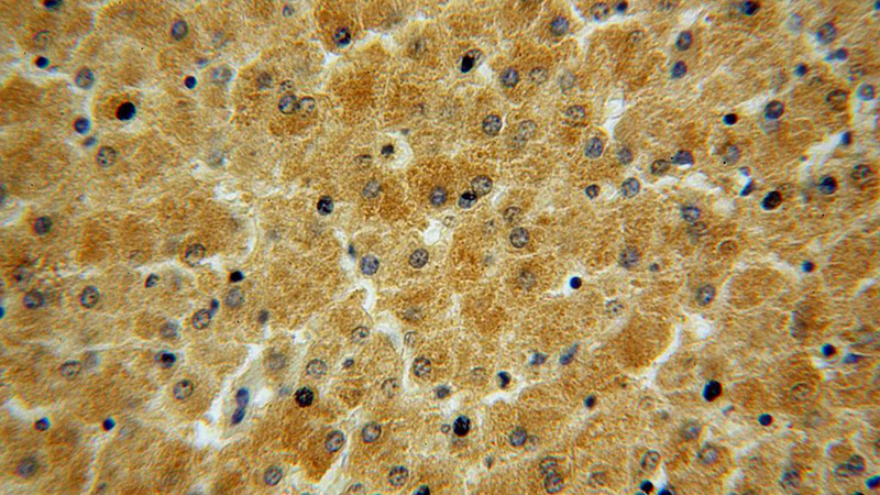 Immunohistochemical of paraffin-embedded human liver using Catalog No:107791(ADHFE1 antibody) at dilution of 1:50 (under 40x lens)