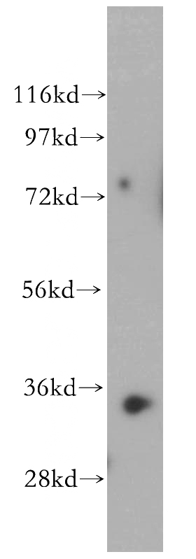 human heart tissue were subjected to SDS PAGE followed by western blot with Catalog No:114688(RENALASE antibody) at dilution of 1:500