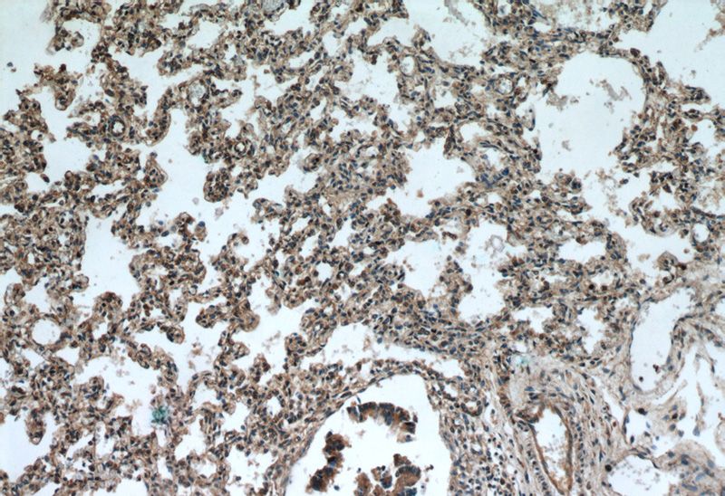 Immunohistochemical of paraffin-embedded human lung using Catalog No:114499(RABGGTA antibody) at dilution of 1:100 (under 10x lens)