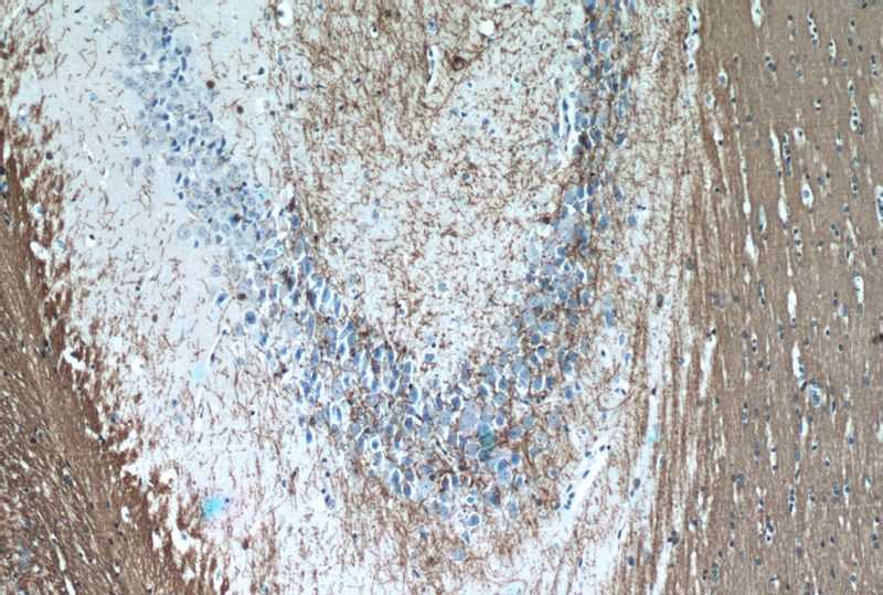 Immunohistochemistry of paraffin-embedded mouse brain tissue slide using Catalog No:109355(CNP Antibody) at dilution of 1:50 (under 10x lens)