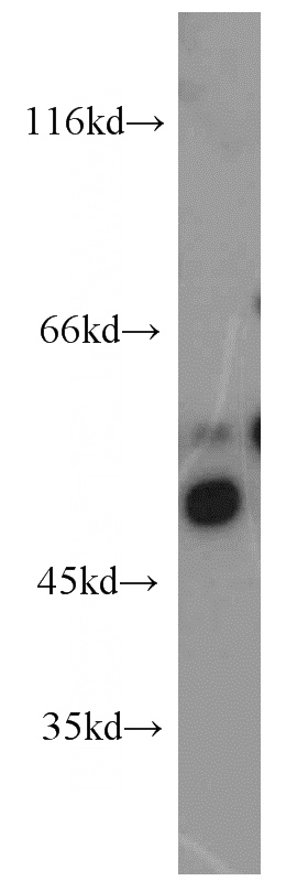 Jurkat cells were subjected to SDS PAGE followed by western blot with Catalog No:116466(BAT1 antibody) at dilution of 1:1000