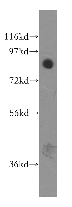 human kidney tissue were subjected to SDS PAGE followed by western blot with Catalog No:112529(MFN1 antibody) at dilution of 1:500